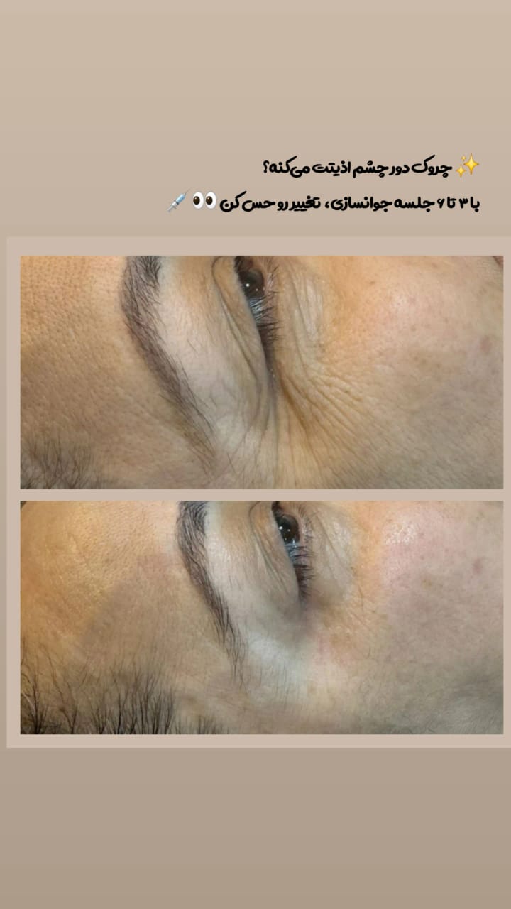 خدمات پاکسازی و درمان پوست یلدا اکبری در شیراز